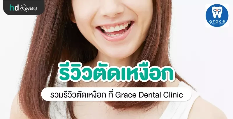 รีวิว ตัดเหงือก ที่ Grace Dental Clinic
