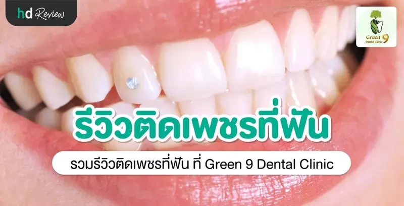 รีวิว ติดเพชรที่ฟัน ที่ Green 9 Dental Clinic