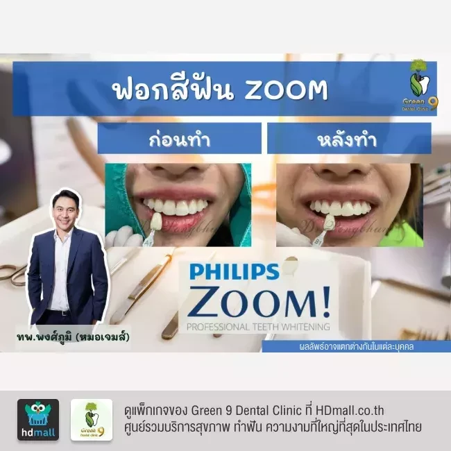 รีวิว ฟอกสีฟันแบบ Zoom ที่ Green 9 Dental Clinic