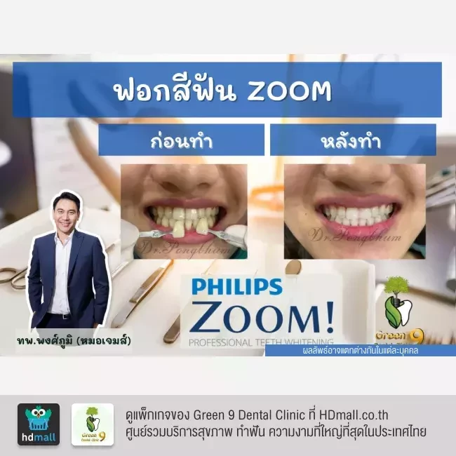 รีวิว ฟอกสีฟันแบบ Zoom ที่ Green 9 Dental Clinic