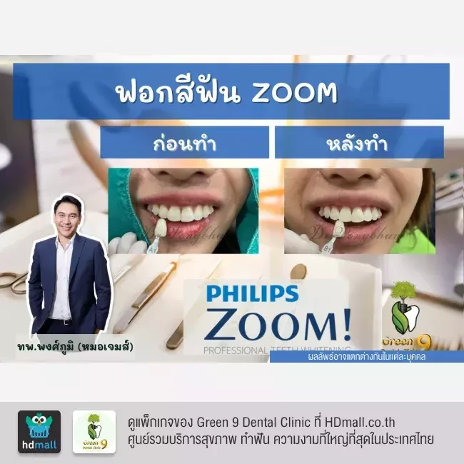 รีวิว ฟอกสีฟันแบบ Zoom ที่ Green 9 Dental Clinic