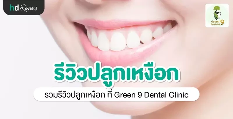รีวิว ปลูกเหงือก ที่ Green 9 Dental Clinic