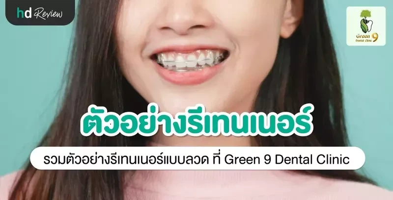 ตัวอย่างรีเทนเนอร์แบบลวด ที่ Green 9 Dental Clinic