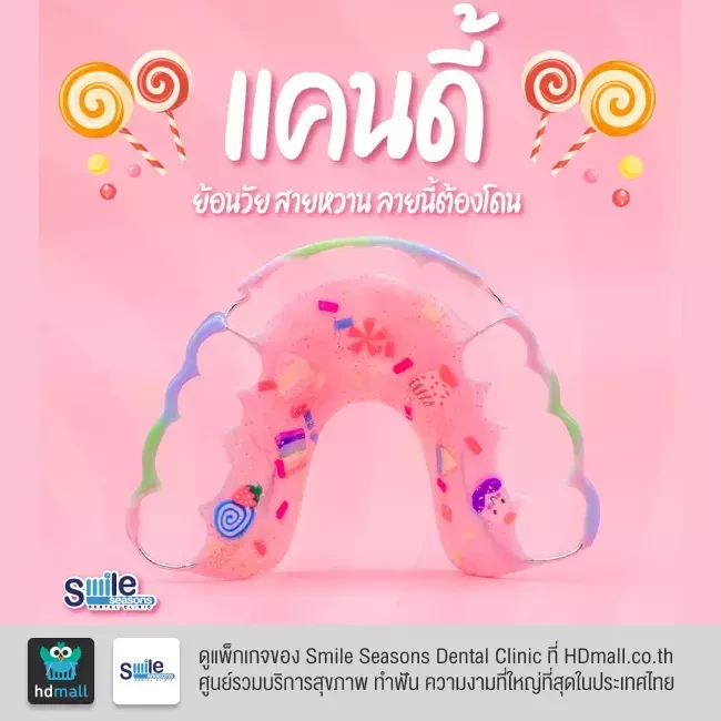 ตัวอย่างรีเทนเนอร์ ที่ Smile Seasons Dental Clinic (คลินิกทันตกรรมสไมล์ซีซันส์)