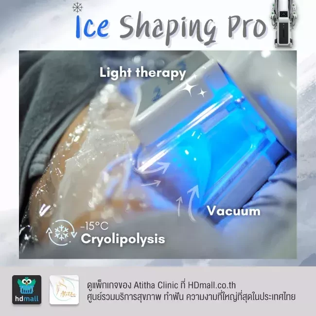 รีวิว สลายไขมันด้วยความเย็น Ice Shaping Pro ที่ Atitha Clinic