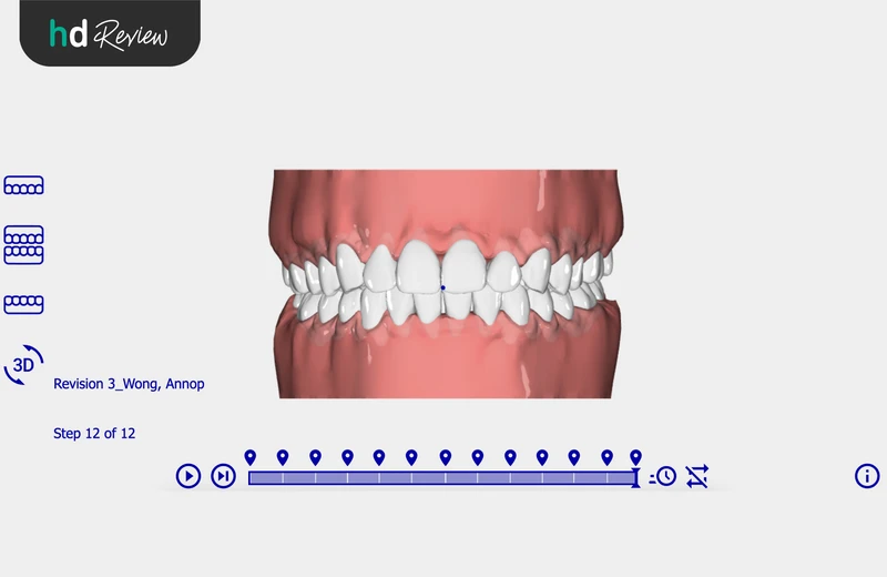 แผนการรักษาแบบ 3D