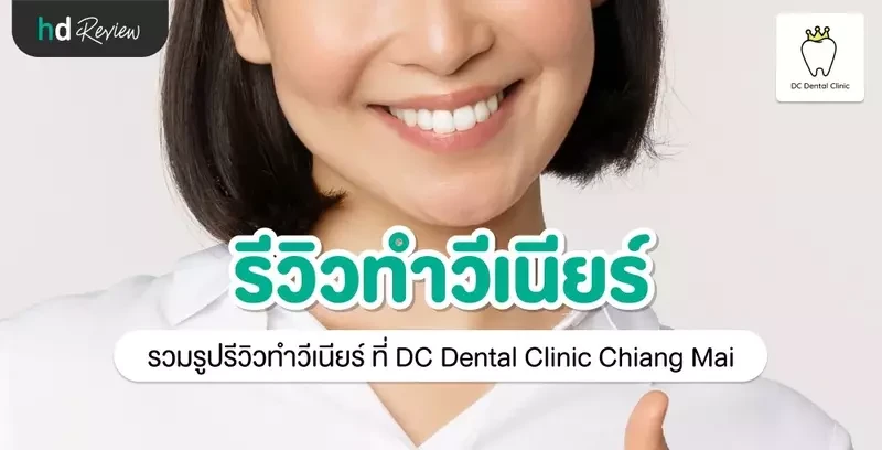 รีวิว ทำวีเนียร์ ที่ DC Dental Clinic Chiang Mai