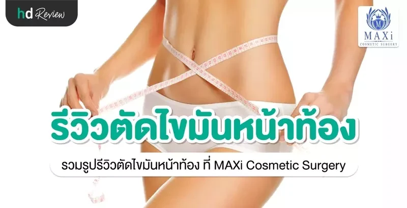 รีวิว ตัดไขมันหน้าท้อง Tummy Tuck (ตัดหนังหน้าท้อง) ที่ MAXi Cosmetic Surgery