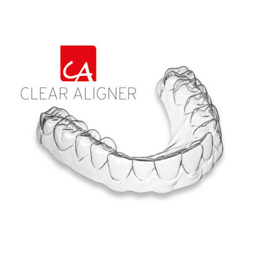 จัดฟันใส Clear Aligner