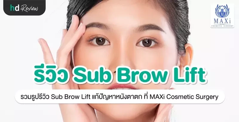 รีวิว Sub Brow Lift แก้ปัญหาหนังตาตก ที่ MAXi Cosmetic Surgery