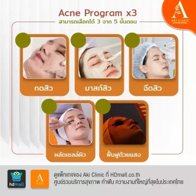 รีวิว รักษาสิว Acne Program ที่ Aki Clinic รูป 1