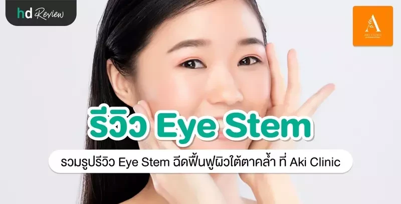 รีวิว Eye Stem ฉีดฟื้นฟูผิวใต้ตาคล้ำ ที่ Aki Clinic