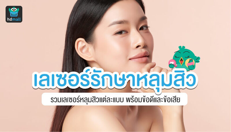 รวมข้อมูลการเลเซอร์รักษาหลุมสิว