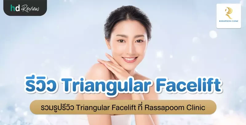 รีวิว Triangular Facelift ที่ Rassapoom Clinic