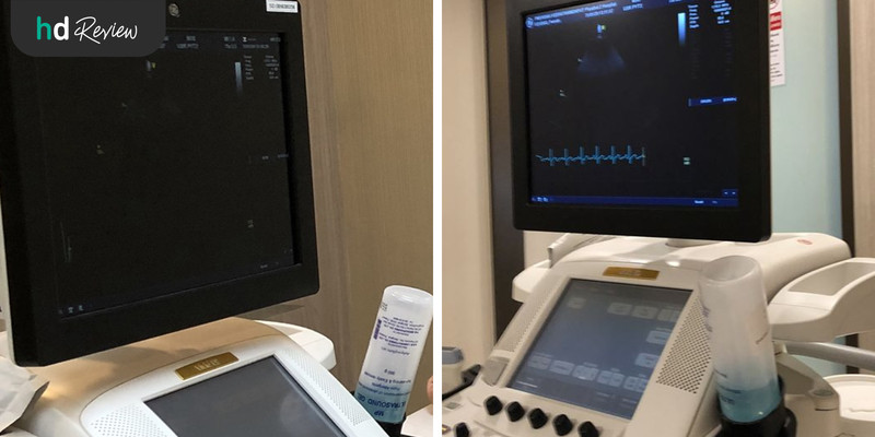 รีวิวโปรแกรมตรวจสุขภาพหัวใจ Echocardiogram ที่โรงพยาบาลพญาไท 2