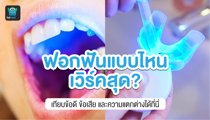 ฟอกสีฟันแบบไหนดีสุด? เปรียบเทียบการฟอกสีฟันแต่ละแบบได้ที่นี่ HDmall