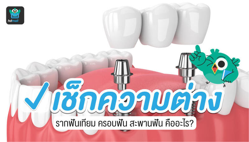 รากฟันเทียม ครอบฟัน สะพานฟัน ต่างกันอย่างไร?