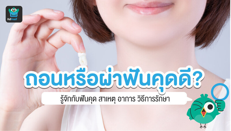 ฟันคุดคืออะไร? ไม่ผ่าได้ไหม? ราคาถอนหรือผ่าฟันคุด เท่าไร?