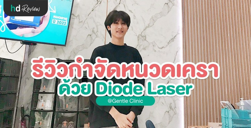 รีวิวเลเซอร์กำจัดหนวดเครา Diode Laser ที่ Gentle Clinic