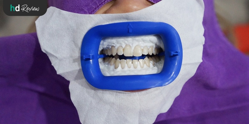 รีวิว ฟอกสีฟัน ระบบ Zoom ที่ Double B Dental Clinic