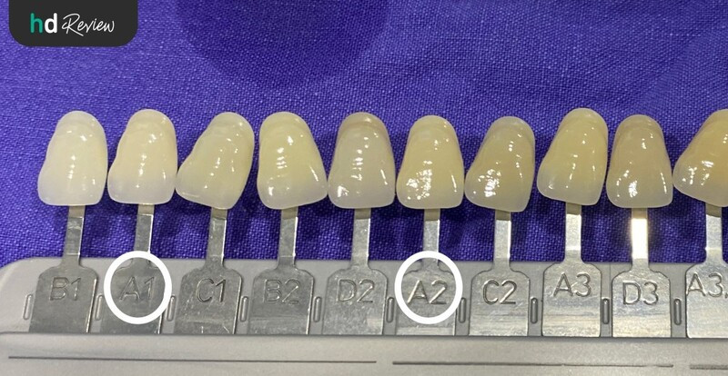 รีวิว ฟอกสีฟัน น้ำยา PolaOffice ที่ Zenitoni Dental Clinic