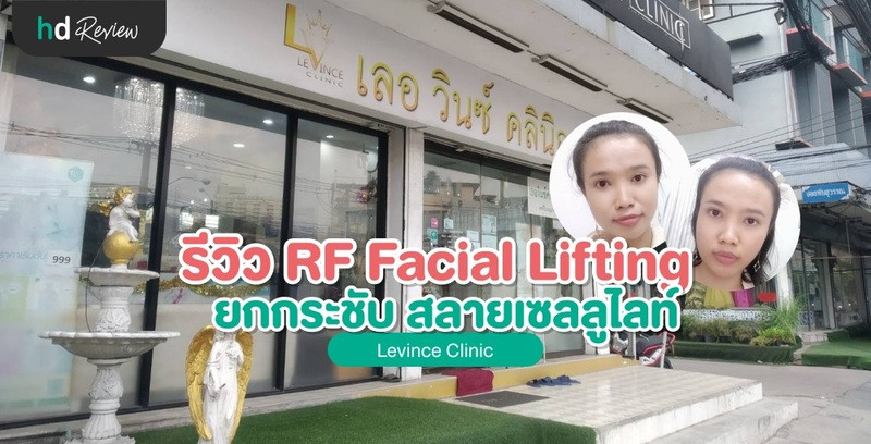 รีวิว RF Facial Lifting ยกกระชับ สลายเซลลูไลท์ ที่ Levince Clinic