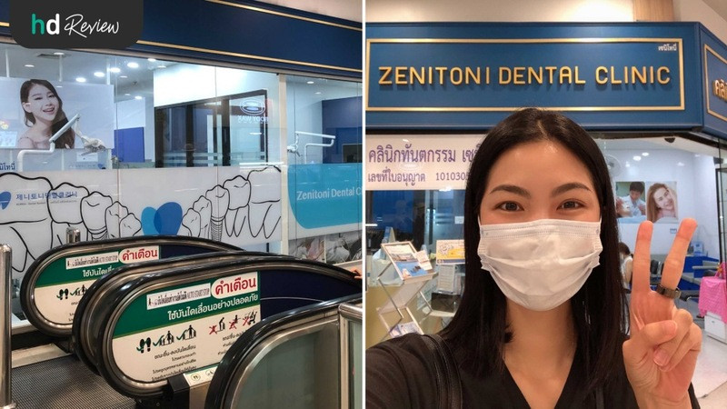 รีวิว ใช้สิทธิประกันสังคม ขูดหินปูน ที่ Zenitoni Dental Clinic