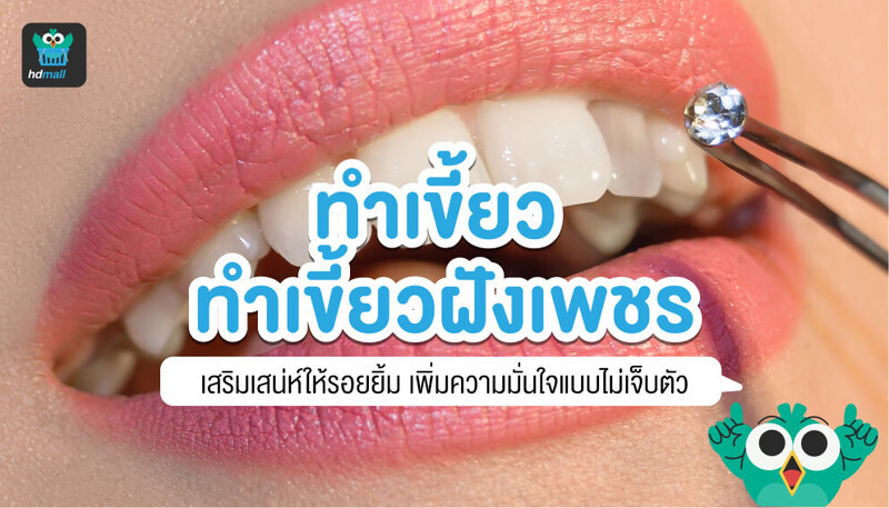 ทำเขี้ยว-ทำเขี้ยวฝังเพชร-ทำฟันเขี้ยว