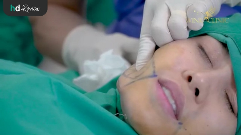รีวิว ดูดไขมันบริเวณหน้า Face Tite ที่ Wink Clinic