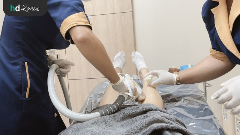 รีวิว กำจัดขนขา ด้วย Diode Laser ที่ Orianna Clinic