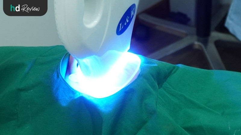 รีวิวฟอกสีฟัน Cool Light และชุดฟอกสีฟัน ที่ Grace Dental Clinic